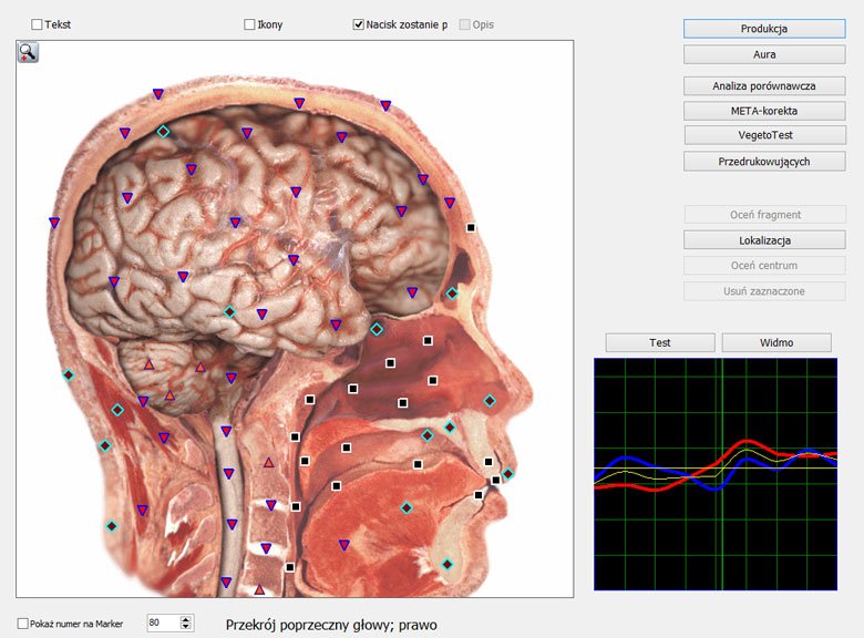 Metatron 4025 Atsiliepimai