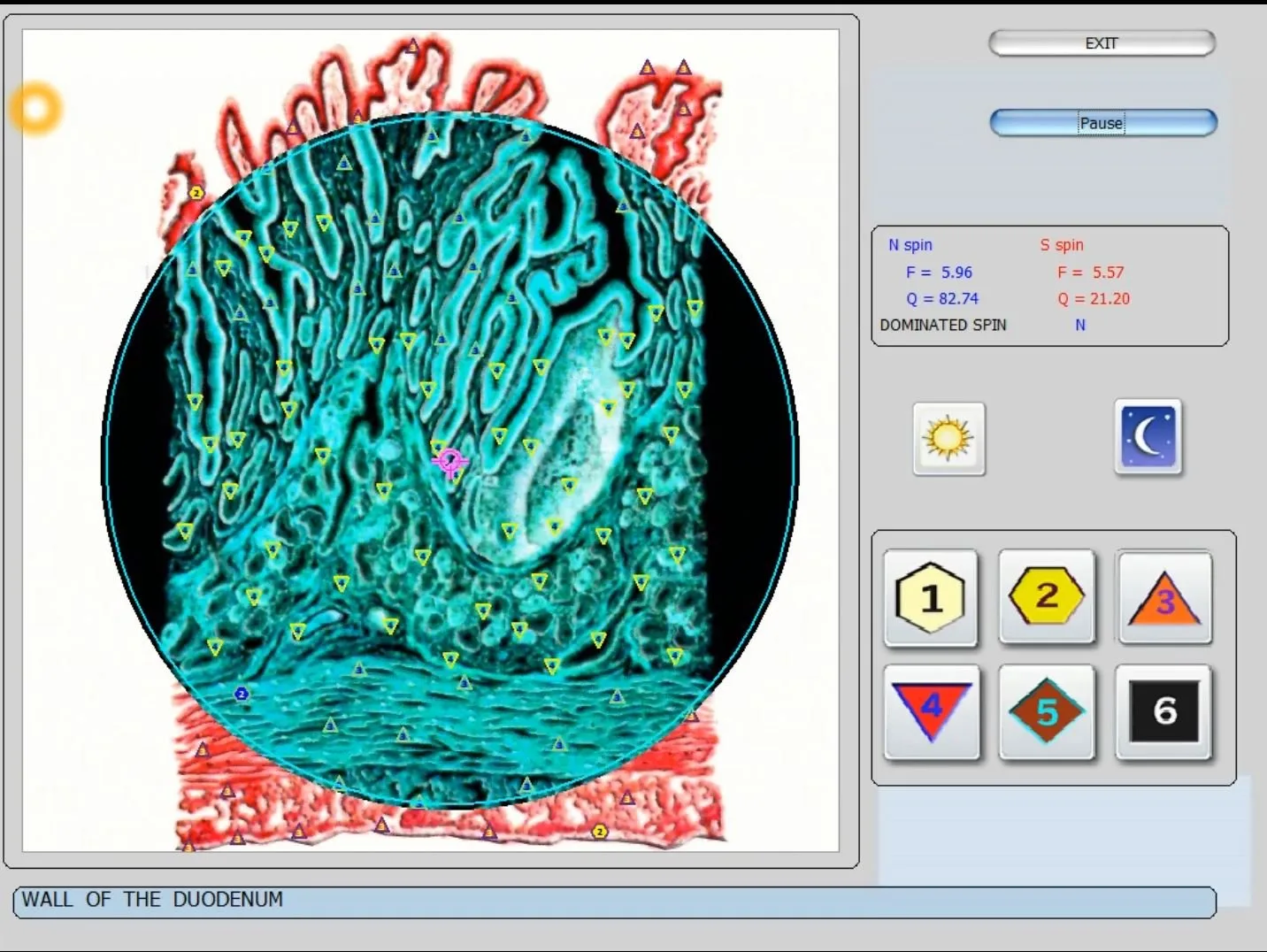 Kokios rizikos ir galimos nepageidaujamos reakcijos pacientams po biorezonanso seansų su Metatron įranga? — vector 8d 9d nls software (30).JPG