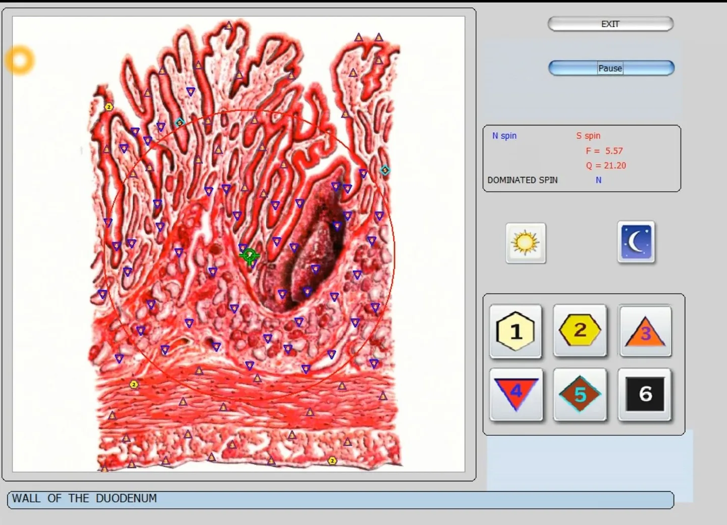 Ar Bioplasm NLS (Bioplasm Machine) tinka platintojui Lietuvoje? Greitas atsakymas ir praktinis patikrinimas — vector 8d 9d nls   software (29).JPG