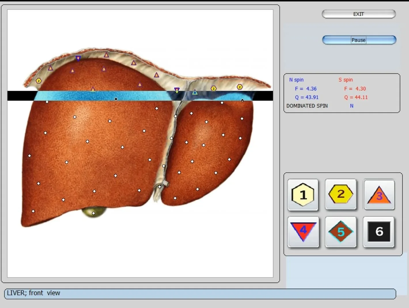 Ar Bioplasm NLS (Bioplasm Machine) tinka platintojui Lietuvoje? Greitas atsakymas ir praktinis patikrinimas — vector 8d 9d nls   software (13).JPG