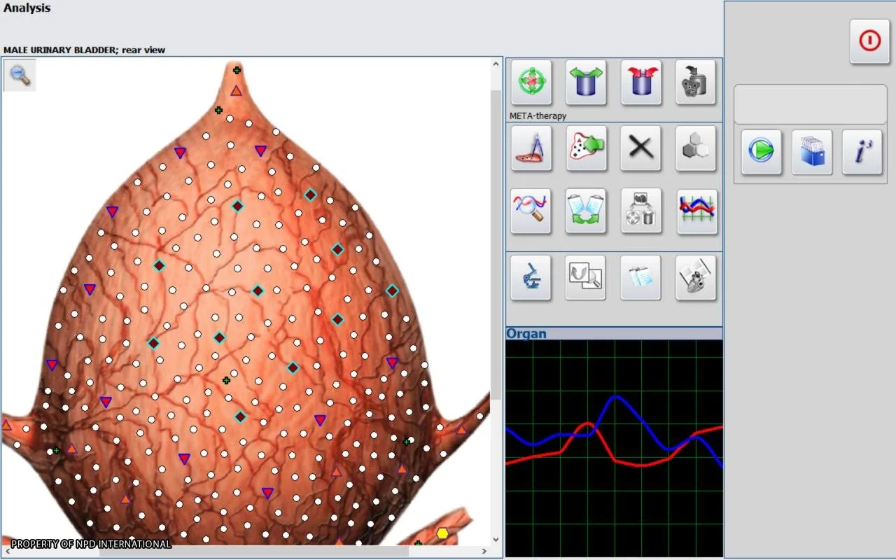 Ar Metatron 4025 suderinamas su kitų gamintojų biofeedback įranga — kokie adapteriai ir protokolai reikalingi platintojo sprendimui? — MAIKONG Hunter 4025 Metatron (4495).JPG
