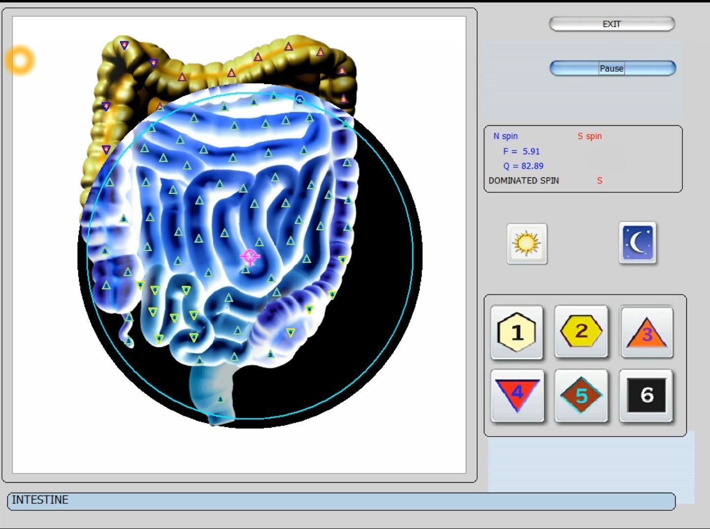 Kaip elgtis, jei Metatron programinė įranga užstringa arba nerodo skenavimo rezultatų? — vector 8d 9d nls   software (33).JPG