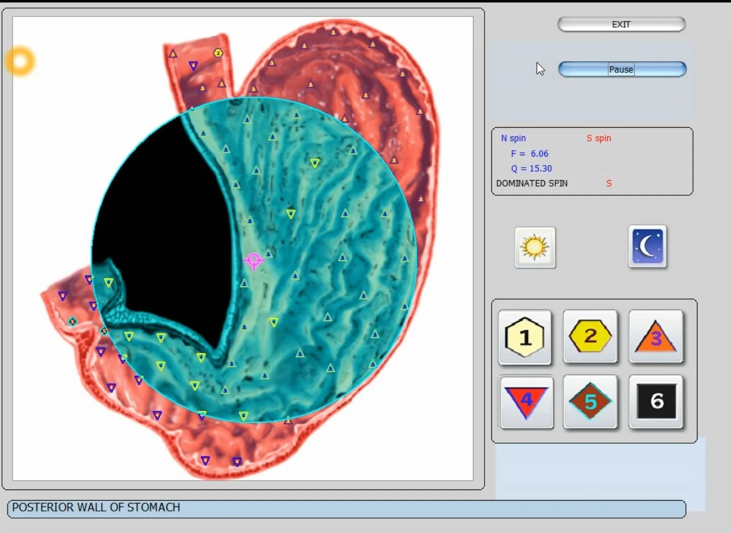 Kokios rizikos ir galimos nepageidaujamos reakcijos pacientams po biorezonanso seansų su Metatron įranga? — vector 8d 9d nls software (24).JPG